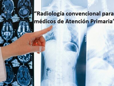 Radiología convencional para médicos de Atención Primaria