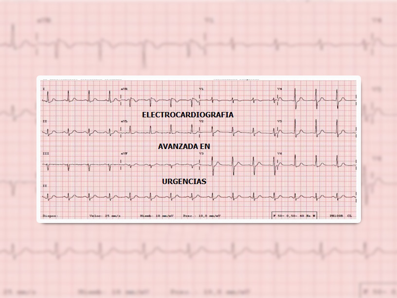 curso-ekg-avanzado curso-ekg-avanzado
